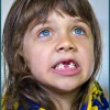 baby-teeth baby-teeth